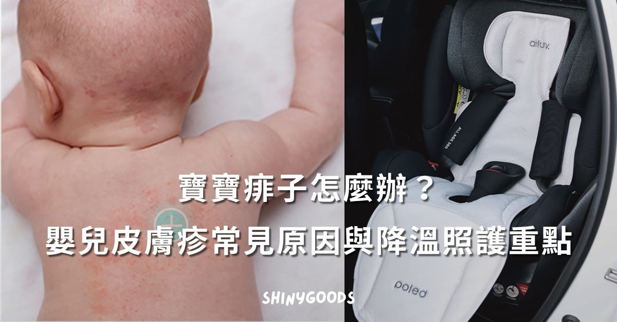 寶寶痱子與嬰兒皮膚疹照護主圖