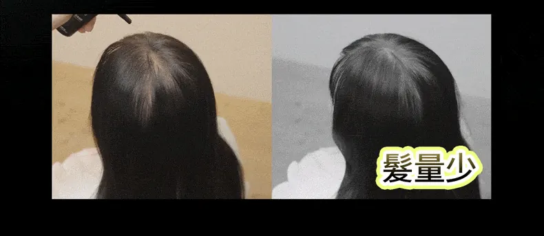 髮量少